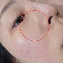 (주)엔에이치에이바이오 | [내돈내산 후기😶‍🌫️]셀라딕스 바이오 포어 케어 셀룰로오스 마스크(모공피지팩)