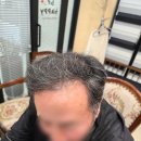 미예뜰 | 광주가발 하나로 변신 끝