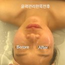카리언