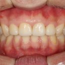 이안치과기공소 이미지