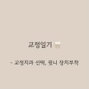 [교정일기] 교정치과선택 + 윗니 장치 부착 🙈🦷 (30대 육아맘 세라믹 교정)