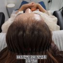 [경기광주] 릿따스타일 - 경기광주두피관리 재방문 후기
