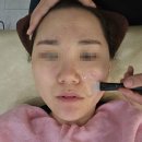 골든IT타워 | 옥길동 피부관리 더뷰티스킨앤왁싱에서 뒤집어진 피부 진정 재생관리