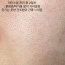 수원-0542 | [수원 인계동 피부 관리] '제이디뷰티' 모공 피지 제거 대만족한 더미스필 약초필 솔직 후기(모공전후...