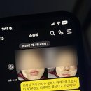 일리터맥스용산역점 | [내돈내산] 복부 & 팔뚝 지방흡입 동시에 조진 후기 1편 (발품~수술당일)