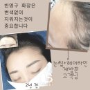 파스텔헤어라인