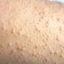 서울성모항정유외과의원 이미지