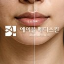 메디스킨 네이버블로그