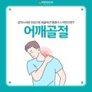 별내바로본의원 | 별내도수치료 별내바로본의원) 어깨 통증이 심하다면, 어깨골절을 의심해보세요