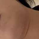 톤즈의원 | 동탄 톤즈의원 내돈내산 슈링크 후기!