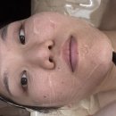 지앤뷰티 | 춘천웨딩관리 지앤뷰티에서 라라필+LDM물방울관리받은 후기