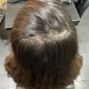 (주)트리엠 | 비에티닥터클린헤드 탈모샴푸 바꿨더니 탈모 비듬 지루성두피까지 해결