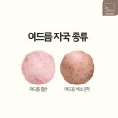 미르엔터테이먼트 | 서울대입구 화이트태닝, 몰디브:: 비포애프터 비교! (+10월 역대급 이벤트)