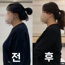 석전한의원 | 한의원 거북목 교정 가능한가요? 방법이 궁금해요 / 마산 재활 필라테스