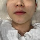 엘로우케어 | 수원 피부관리 라라필 후기 &#39;오브에스테틱 수원금곡점&#39;
