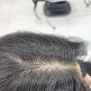 씽씽카크리닉 | [김해율하미용실] 베이즈헤어 : 합리적인 비용의 두피클리닉 후기