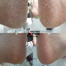 레푸스 구로점 이미지