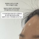 유주왕외과의원 | 염증부사 패임, 염증주사 부작용 염증주사함몰 한달후 기록