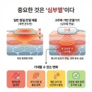 원앤원 플러스 | 집에서 시작한 체온 관리 습관 변화 원앤원플러스 닥터K큐어 고주파 온열기 렌탈 실제 사용 후기와 느낀 점