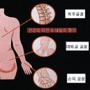 골다공증의 이해와 치료 이미지