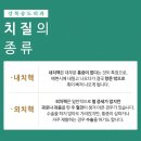 항문 건강 10계명 이미지