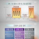 간, 소리없이 무너진다(EBS 명의 463회) 이미지