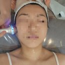 채움락 | 망포 피부관리 가은에스테틱 채움실물광테라피 관리 후기
