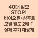 박영희피부관리 | 40대 탈모 SOS! 바이오틴+기능성샴푸로 모발 밀도 2배 늘린 실제 후기