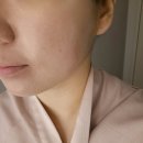 [목동 피부관리] 목동 웨딩관리 목동 바디관리 달리아 에스테틱 목동점