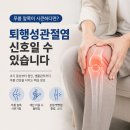고려탑마취통증의학과의원 | 무릎 앞쪽이 시큰하다면, 퇴행성관절염의 신호일 수도 있습니다