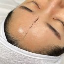 쏘앤 - 중구 우현로 67 | 스킨플래닝 잘하는 부평에스테틱 쏘앤뷰티 후기