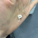 아젤리아 | 아젤리아 크림 후기 아젤리아 부작용 모낭염을 얻었어요!