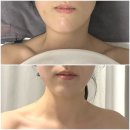 부산 피부관리 에스테틱 수기미인 서면 V라인 리프팅✨ㅣ서면 에스테틱 작은얼굴 경락 추천