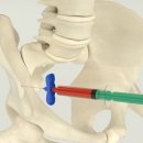 신의료기 이미지