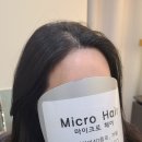 마이크로헤어증모 이미지
