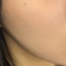 뷰티초이스 | 구래동피부관리 초이스뷰티 모공케어 관리 후기