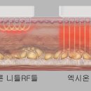 엑시온(Exion) 이미지