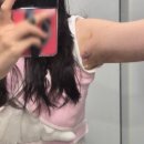 [갑상선암 수술일기6]30대 여자 갑상선암 로봇수술 2주 후기 (통증, 후유증, 수술부위 사진)