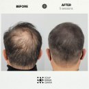 스칼프디자인센터 이미지