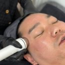 빛나 | 배곧에스테틱 추천 :&gt; 리프팅·피부관리 잘하는 곳 ‘빛나보라’ 엑스터 시술 후기