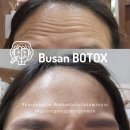 동그마니 | 부산 제오민 보톡스 잘놓는 피부과 경성대 피부과