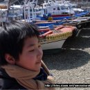 편도선암[편도암]4기 방사선치료후 곧바로 폐렴 발생 사망[항암제로 살해당하다] 이미지