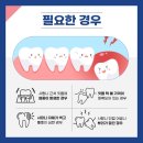 예플란트치과의원 이미지