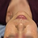 (구리인창피부체형고객후기)한의사가 시키는대로 하면 복부가스로 죽을수도 있습니다~~손님은 시계반대...