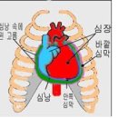 심낭염[pericarditis , 心囊炎 , ＜일＞しんのうえん] 이미지