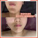 비채길 | 부천피부관리 미인비채 이중턱 윤곽관리 받은 후기
