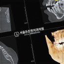 든든한의원 | 믿음직한 병원에서 건강한 치아 관리의 시작 - 군자역 치과 서울든든한치과 후기