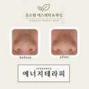 인천피부관리 윤곽관리 확실하게 되는 석남동 &#34;유소현 에스테틱 앤 왁싱&#34;에서 에너지테라피 받고 온 후기