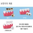 바른이플란트치과의원 이미지