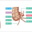 충수염 맹장염 충수돌기염 원인 증상 오른쪽 배 통증 복부통증 이미지